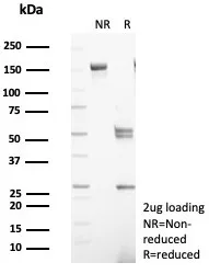 SDS-PAGE Analysis of Purified S100G Mouse Monoclonal Antibody (S100G/7516). Confirmation of Purity and Integrity of Antibody.
