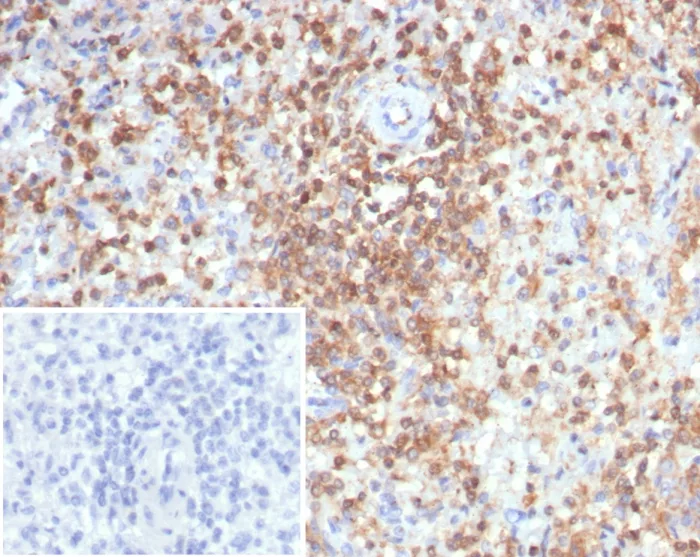 Formalin-fixed, paraffin-embedded human spleen stained with S100G Mouse Monoclonal Antibody (S100G/7516). Inset: PBS instead of primary antibody; secondary only negative control. S100G (S100 calcium binding protein G) Antibody - Image 2