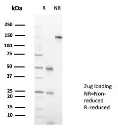 SDS-PAGE Analysis of Purified MZF1 Mouse Monoclonal Antibody (PCRP-MZF1-1E8). Confirmation of Purity and Integrity of Antibody.