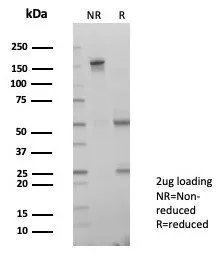 SDS-PAGE Analysis of Purified LIN28A Mouse Monoclonal Antibody (PCRP-LIN28A-1E2). Confirmation of Purity and Integrity of Antibody.