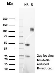 SDS-PAGE Analysis of Purified FGF23 Mouse Monoclonal Antibody (FGF23/6408). Confirmation of Purity and Integrity of Antibody. FGF23 (Fibroblast Growth Factor 23) Antibody - Image 2