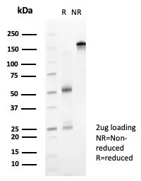 SDS-PAGE Analysis of Purified ZNF239 Mouse Monoclonal Antibody (PCRP-ZNF239-2A10). Confirmation of Purity and Integrity of Antibody.