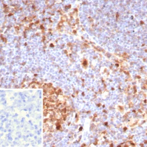 Formalin-fixed, paraffin-embedded human lymph node stained with Caspase 3 Mouse Monoclonal Antibody (CASP3/8446). Inset: PBS instead of primary antibody; secondary only negative control.