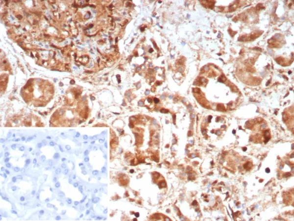Formalin-fixed, paraffin-embedded human kidney stained with Caspase 7 Mouse Monoclonal Antibody (CASP7/9051). Inset: PBS instead of primary antibody; secondary only negative control.