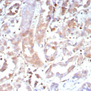 Formalin-fixed, paraffin-embedded human kidney stained with Caspase 7 Mouse Monoclonal Antibody (CASP7/9052). HIER: Tris/EDTA, pH9.0, 45min. 2°C: HRP-polymer, 30min. DAB, 5min.