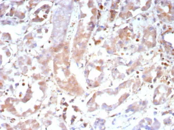 Formalin-fixed, paraffin-embedded human kidney stained with Caspase 7 Mouse Monoclonal Antibody (CASP7/9052). HIER: Tris/EDTA, pH9.0, 45min. 2°C: HRP-polymer, 30min. DAB, 5min.