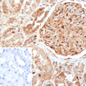 Formalin-fixed, paraffin-embedded human kidney stained with Caspase 7 Mouse Monoclonal Antibody (CASP7/9054). Inset: PBS instead of primary antibody; secondary only negative control.
