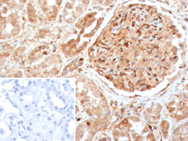 Formalin-fixed, paraffin-embedded human kidney stained with Caspase 7 Mouse Monoclonal Antibody (CASP7/9054). Inset: PBS instead of primary antibody; secondary only negative control.