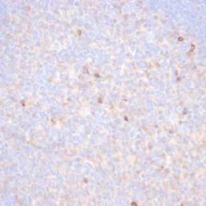 Formalin-fixed, paraffin-embedded human tonsil stained with TIM3 Recombinant Rabbit Monoclonal Antibody (TIM3/6863R). HIER: Tris/EDTA, pH9.0, 45min. 2°C: HRP-polymer, 30min. DAB, 5min.