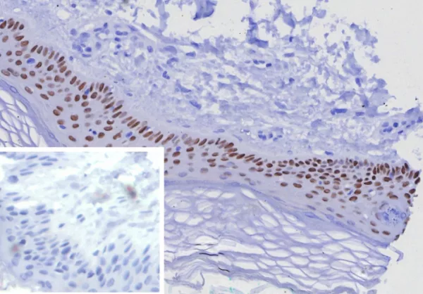 Formalin-fixed, paraffin-embedded human skin stained with  p63 Recombinant Rabbit Monoclonal Antibody (TP63/7807R). Inset: PBS instead of primary antibody; secondary only negative control.