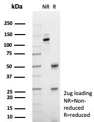 SDS-PAGE Analysis of Purified ABCB11 / BSEP Mouse Monoclonal Antibody (BSEP/7534). Confirmation of Purity and Integrity of Antibody.