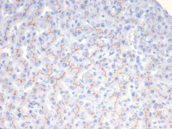 Formalin-fixed, paraffin-embedded human liver stained with ABCB11 / BSEP Mouse Monoclonal Antibody (BSEP/7534). HIER: Tris/EDTA, pH9.0, 45min. 2°C: HRP-polymer, 30min. DAB, 5min.