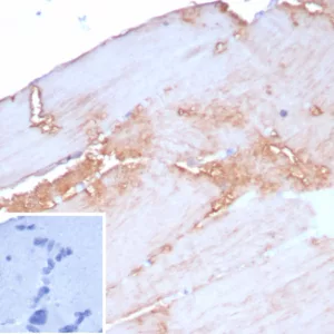 Formalin-fixed, paraffin-embedded human skeletal muscle stained with ACTN2 Recombinant Mouse Monoclonal Antibody (rACTN2/8177). Inset: PBS instead of primary antibody; secondary only negative control.
