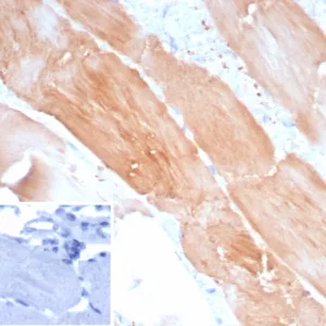 Formalin-fixed, paraffin-embedded human skeletal muscle stained with ACTN2 Recombinant Rabbit Monoclonal Antibody (ACTN2/8184R). Inset: PBS instead of primary antibody; secondary only negative control.