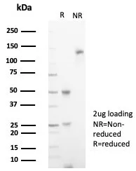 SDS-PAGE Analysis of Purified IL18R1 Mouse Monoclonal Antibody (IL18R1/7592). Confirmation of Purity and Integrity of Antibody.