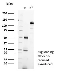 SDS-PAGE Analysis of Purified IL18R1 Mouse Monoclonal Antibody (IL18R1/7593). Confirmation of Purity and Integrity of Antibody.