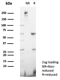 SDS-PAGE Analysis of Purified NRP1 / Neuropilin-1 Mouse Monoclonal Antibody (NRP1/4620). Confirmation of Purity and Integrity of Antibody.