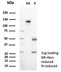 SDS-PAGE Analysis  Purified CD133 / Prominin Mouse Monoclonal Antibody (PROM/1510). Confirmation of Purity and Integrity of Antibody.