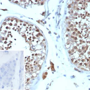 Formalin-fixed, paraffin-embedded human testis stained with Cyclin B1 Rabbit Recombinant Monoclonal Antibody (CCNB1/9242R). Inset: PBS instead of primary antibody; secondary only negative control.