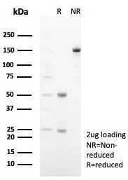 SDS-PAGE Analysis of Purified SIGLEC10 Mouse Monoclonal Antibody (SIGLEC10/7583). Confirmation of Purity and Integrity of Antibody.