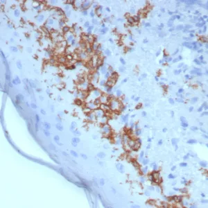 Formalin-fixed, paraffin-embedded human skin stained with  CD1a Mouse Recombinant Monoclonal Antibody (rC1A/8110). HIER: Tris/EDTA, pH9.0, 45min. 2: HRP-polymer, 30min. DAB, 5min.