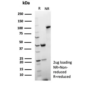 SDS-PAGE Analysis of Purified CD2 Recombinant Mouse Monoclonal Antibody (rLFA2/8516). Confirmation of Purity and Integrity of Antibody.