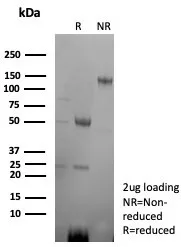SDS-PAGE Analysis of Purified CD2 Recombinant Rabbit Monoclonal Antibody (LFA2/8845R). Confirmation of Purity and Integrity of Antibody.