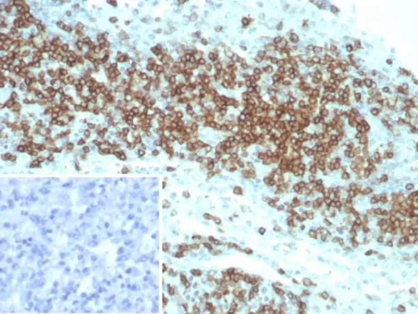 Formalin-fixed, paraffin-embedded human lymph node stained with CD2 Recombinant Rabbit Monoclonal Antibody (LFA2/8845R). HIER: Tris/EDTA, pH9.0, 45min. 2°C: HRP-polymer, 30min. DAB, 5min.