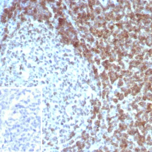 Formalin-fixed, paraffin-embedded human tonsil stained with CD3D Mouse Monoclonal Antibody (CD3D/8898).  Inset: PBS instead of primary antibody; secondary only negative control.