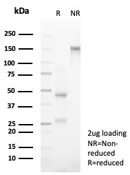 SDS-PAGE Analysis of Purified CD3e Recombinant Mouse Monoclonal Antibody (rC3e/6966). Confirmation of Purity and Integrity of Antibody.