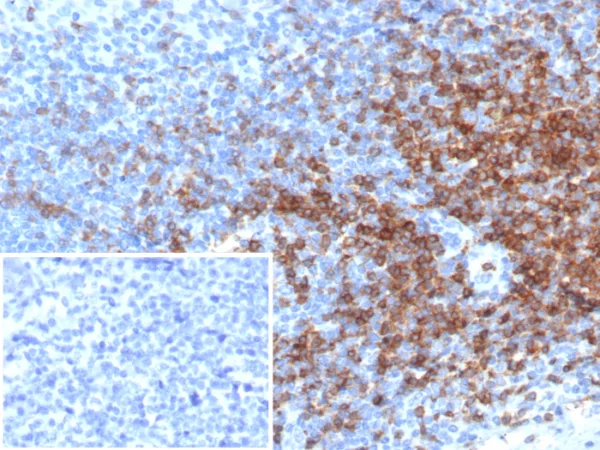 Formalin-fixed, paraffin-embedded human tonsil stained with CD3e Recombinant Mouse Monoclonal Antibody (rC3e/6966).  Inset: PBS instead of primary antibody; secondary only negative control.