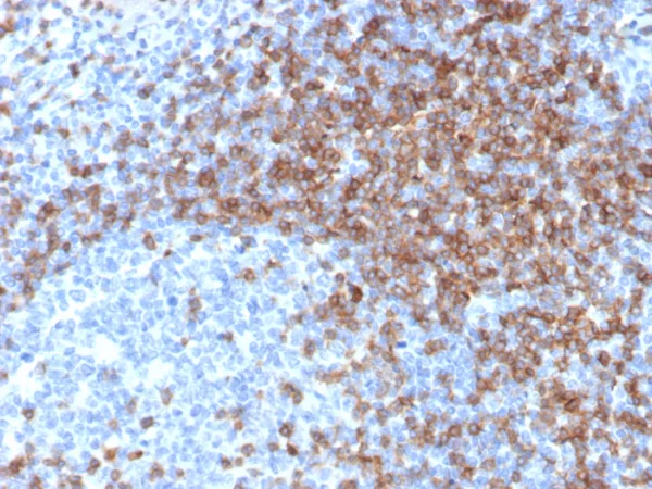 IHC analysis of formalin-fixed, paraffin-embedded human tonsil. CD3e Recombinant Mouse Monoclonal Antibody (rC3e/6966).  HIER: Tris/EDTA, pH9.0, 45min. 2: HRP-polymer, 30min. DAB, 5min.