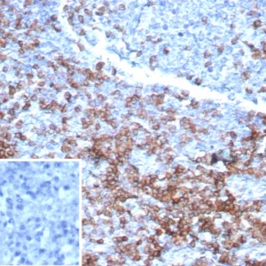 Formalin-fixed, paraffin-embedded human lymph node stained with CD3e Recombinant Mouse Monoclonal Antibody (rC3e/6967).  Inset: PBS instead of primary antibody; secondary only negative control.