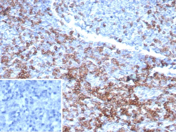 Formalin-fixed, paraffin-embedded human lymph node stained with CD3e Recombinant Mouse Monoclonal Antibody (rC3e/6967).  Inset: PBS instead of primary antibody; secondary only negative control.
