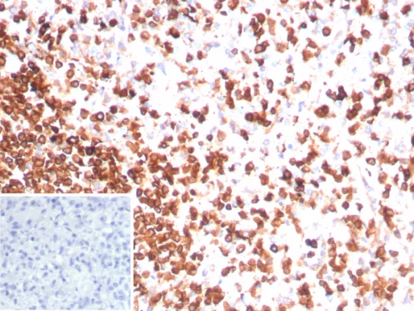 Formalin-fixed, paraffin-embedded human spleen stained with CD3e Recombinant Mouse Monoclonal Antibody (rC3e/8881).  Inset: PBS instead of primary antibody; secondary only negative control.