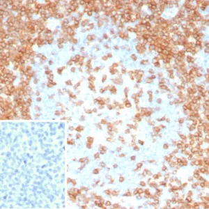 Formalin-fixed, paraffin-embedded human tonsil stained with CD3e Recombinant Rabbit Monoclonal Antibody (C3e/8115R). Inset: PBS instead of primary antibody; secondary only negative control.