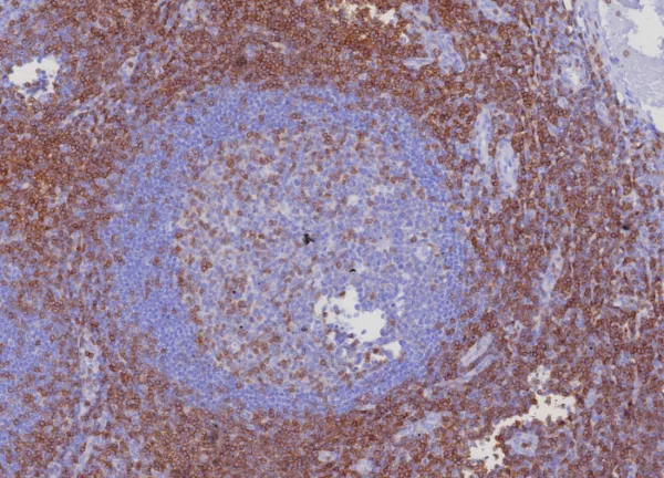 Formalin-fixed, paraffin-embedded human tonsil stained with CD3e Recombinant Rabbit Monoclonal Antibody (C3e/8116R). HIER: Tris/EDTA, pH9.0, 45min. 2: HRP-polymer, 30min. DAB, 5min.