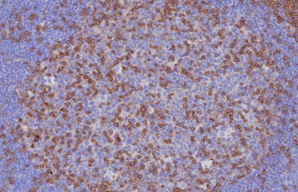 Formalin-fixed, paraffin-embedded human tonsil stained with CD3e Recombinant Rabbit Monoclonal Antibody (C3e/8116R).  HIER: Tris/EDTA, pH9.0, 45min. 2: HRP-polymer, 30min. DAB, 5min.