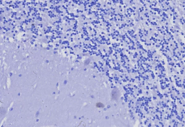 IHC analysis of formalin-fixed, paraffin-embedded human brain. Negative tissue control using C3e/8116R at 2ug/ml in PBS for 30min RT.  HIER: Tris/EDTA, pH9.0, 45min. 2: HRP-polymer, 30min. DAB, 5min.