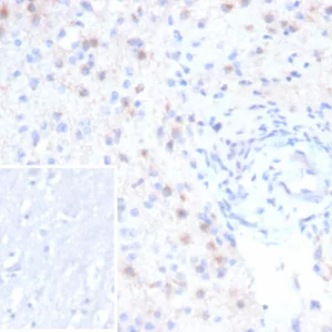 Formalin-fixed, paraffin-embedded human brain stained with RCAS1 Recombinant Mouse Monoclonal Antibody (rEBAG9/7264). Inset: PBS instead of primary antibody; secondary only negative control.
