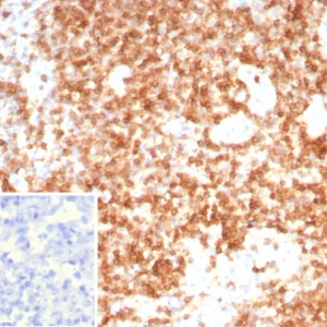Formalin-fixed, paraffin-embedded human lymph node stained with CD3G / CD3beta1 Mouse Monoclonal Antibody (CD3G/8794). Inset: PBS instead of primary antibody; secondary only negative control.