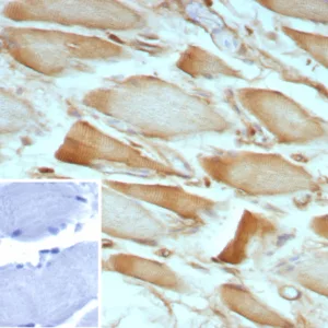 Formalin-fixed, paraffin-embedded human skeletal muscle stained with ZNF804A Mouse Monoclonal Antibody (ZNF804A/8945). Inset: PBS instead of primary antibody; secondary only negative control.