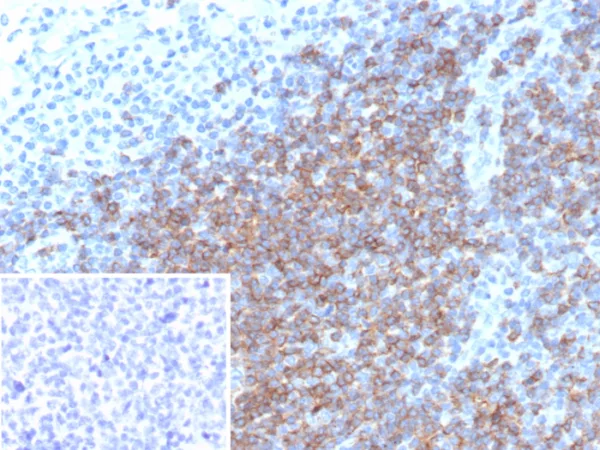 Formalin-fixed, paraffin-embedded human tonsil stained with CD5 Recombinant Mouse Monoclonal Antibody (rC5/6976). Inset: PBS instead of primary antibody; secondary only negative control.