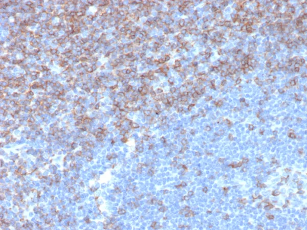Formalin-fixed, paraffin-embedded human tonsil stained with CD5 Recombinant Mouse Monoclonal Antibody (rC5/6976). HIER: Tris/EDTA, pH9.0, 45min. 2: HRP-polymer, 30min. DAB, 5min.