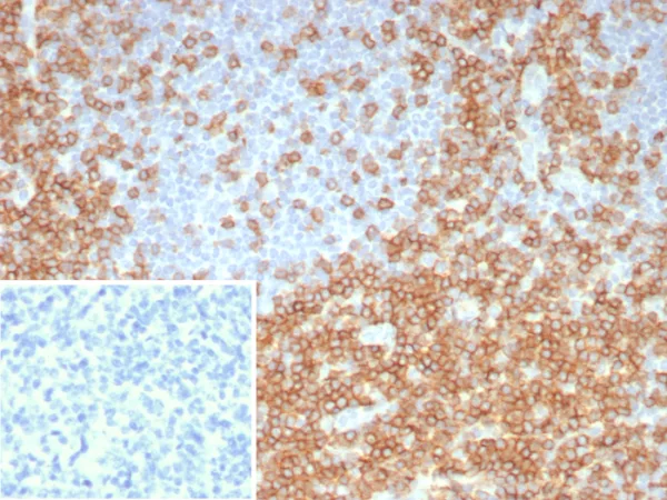 Formalin-fixed, paraffin-embedded human tonsil stained with CD5 Recombinant Rabbit Monoclonal Antibody (C5/8117R). Inset: PBS instead of primary antibody; secondary only negative control.