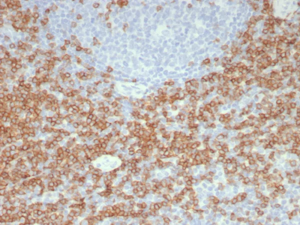 Formalin-fixed, paraffin-embedded human tonsil stained with CD5 Recombinant Rabbit Monoclonal Antibody (C5/8117R). HIER: Tris/EDTA, pH9.0, 45min. 2: HRP-polymer, 30min. DAB, 5min.