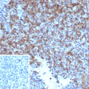 Formalin-fixed, paraffin-embedded human tonsil stained with CD6 Recombinant Mouse Monoclonal Antibody (rC6/372). Inset: PBS instead of primary antibody; secondary only negative control.
