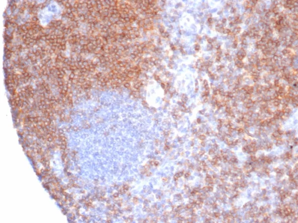 Formalin-fixed, paraffin-embedded human tonsil stained with CD6 Recombinant Mouse Monoclonal Antibody (rC6/372). HIER: Tris/EDTA, pH9.0, 45min. 2°C: HRP-polymer, 30min. DAB, 5min.