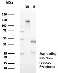 SDS-PAGE Analysis of Purified CD7 Recombinant Mouse Monoclonal Antibody (rCD7/6972). Confirmation of Purity and Integrity of Antibody.