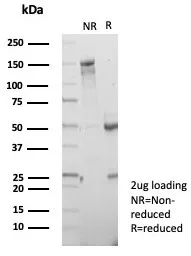 SDS-PAGE Analysis of Purified CD7 Mouse Monoclonal Antibody (CD7/7605). Confirmation of Purity and Integrity of Antibody.